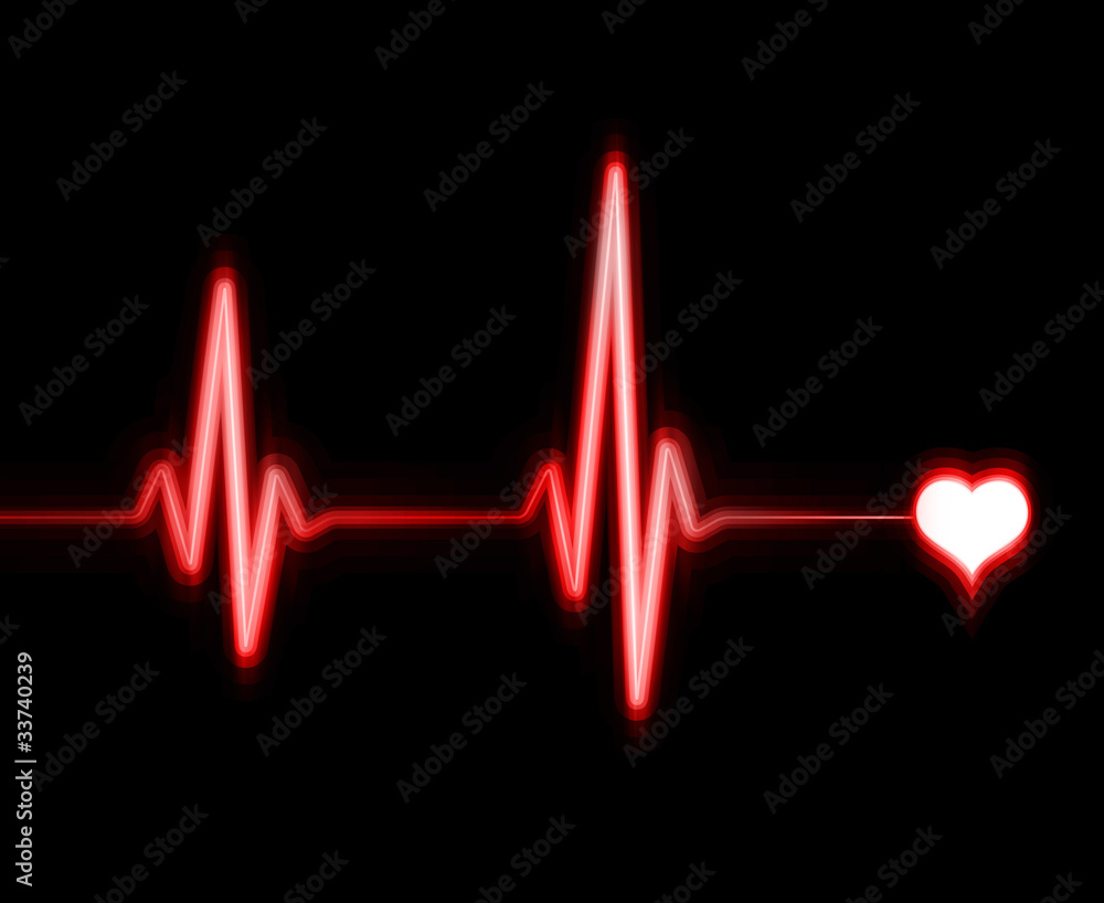 ekg ekg