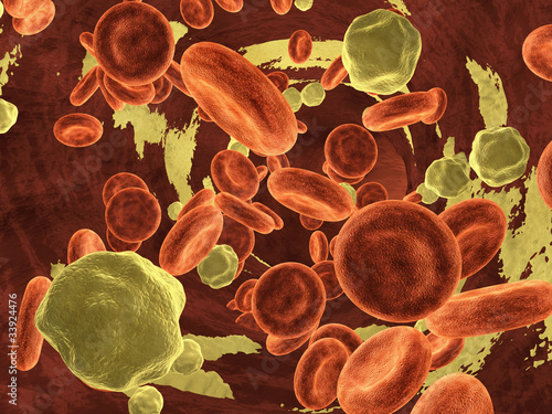 фотографія Cholesterol in a vein