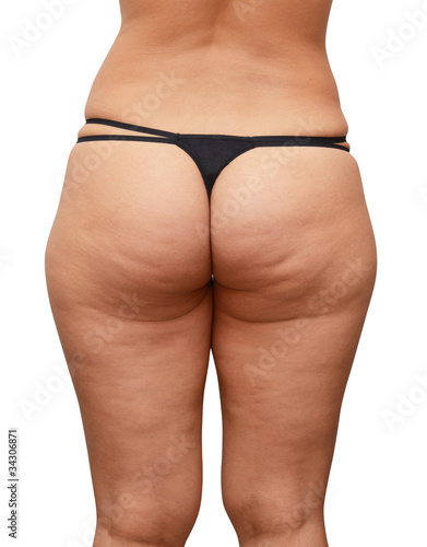 Fototapeta cellulite buttocks