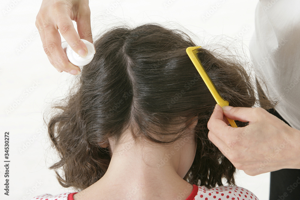 Obraz premium Éradication des poux et lentes sur les enfants