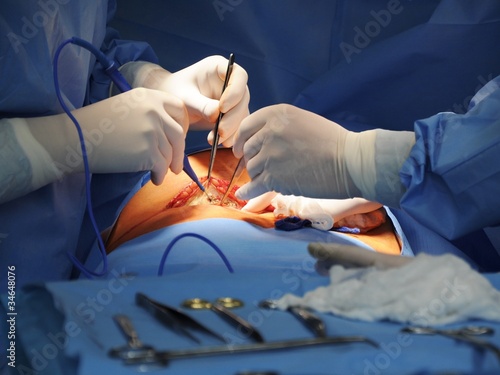 Surgical operation on a  blue background