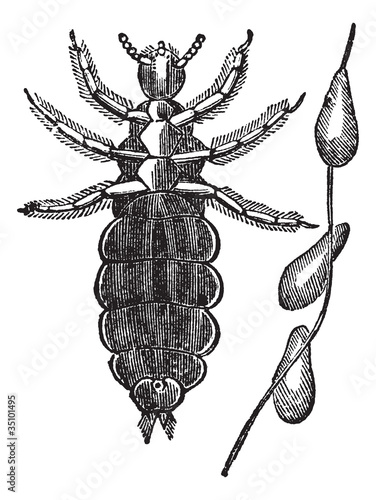 Head lice or Pediculus humanus capitis vintage engraving