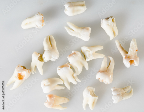Obraz na płótnie remote root human teeth w salonie