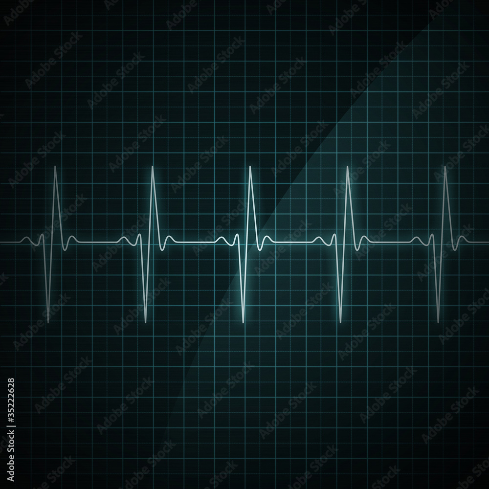 Heart Beat Monitor