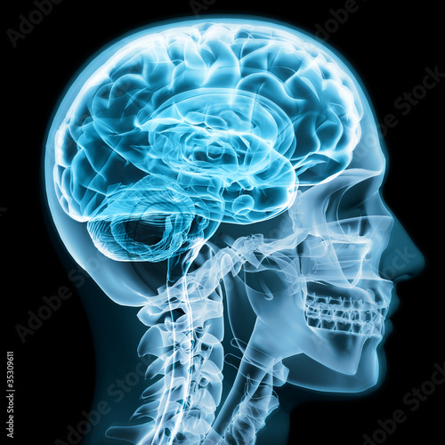 Obraz na plátně X-ray close up with brain and skull concept