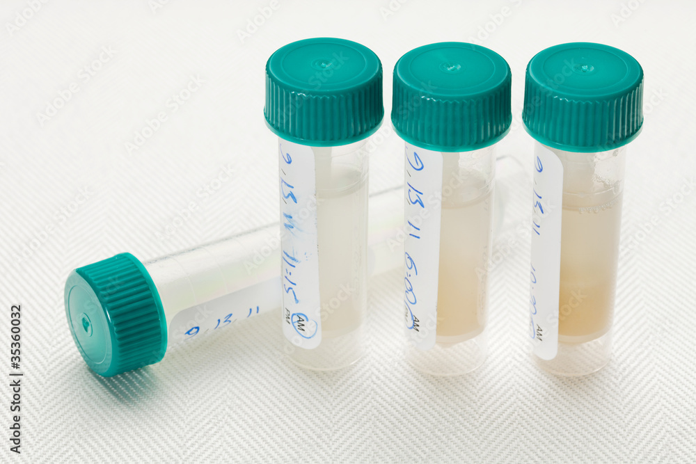 Foto saliva samples for laboratory test