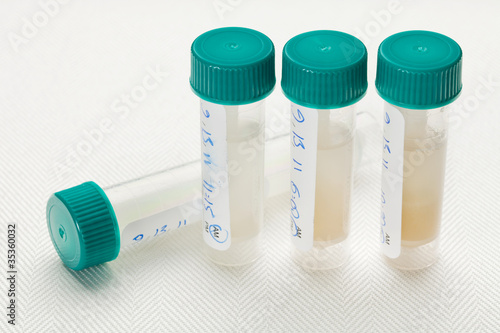 saliva samples for laboratory test photo