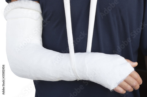 Braccio con Doccia Gessata