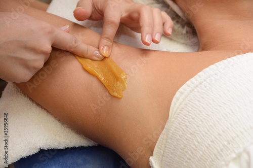 sugaring epilation