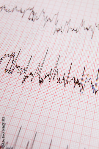 ECG print out