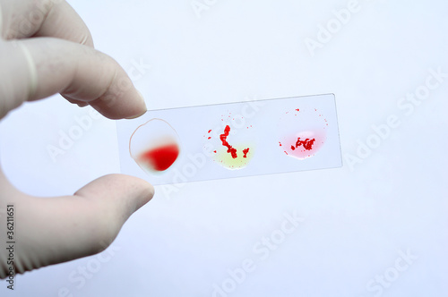 Blood group testing photo