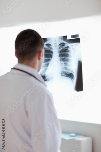 Doctor using light to check x-ray