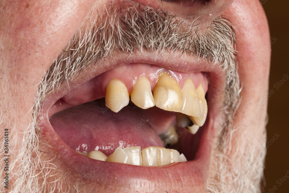 Obraz premium Offener Mund