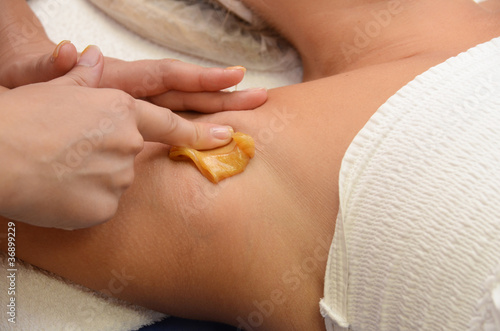 sugaring epilation