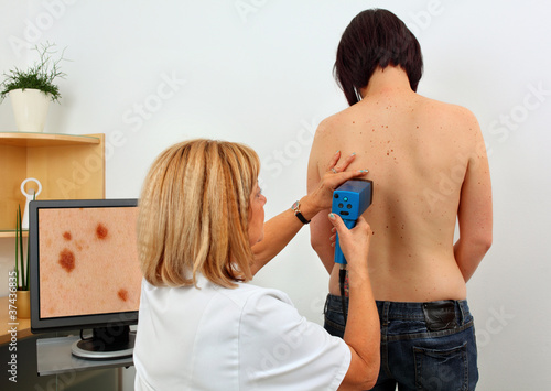 medical examination of birthmark