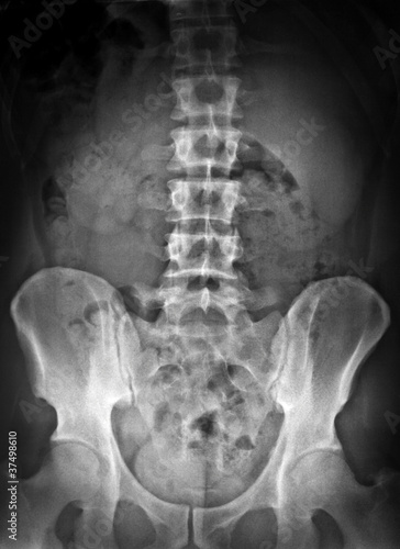 radiografia dell'addome