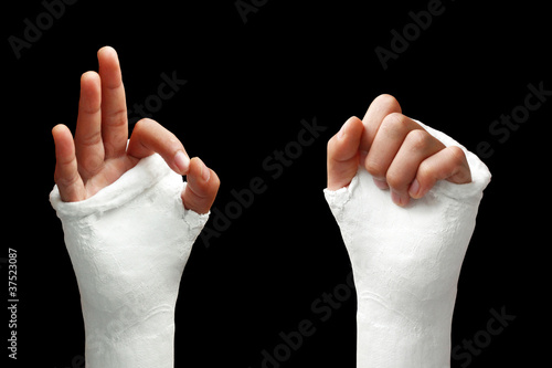 Broken arm - 05