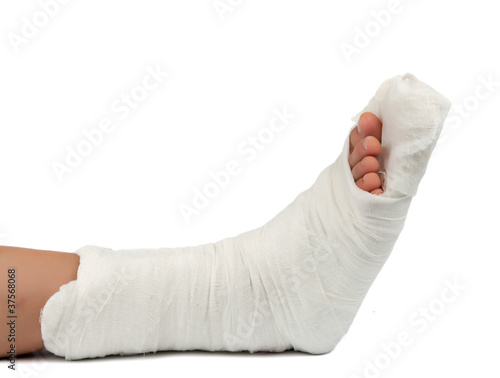 leg in a plaster cast photo