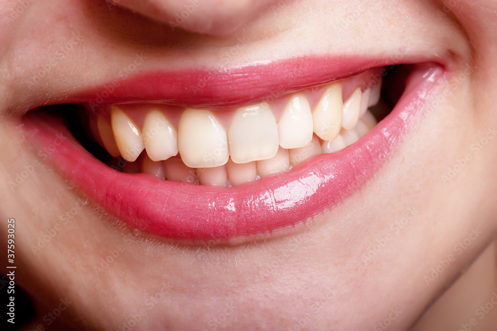Smile Smile