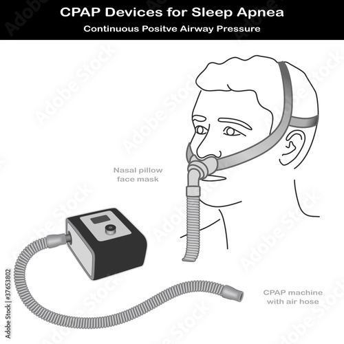 Sleep Apnea, CPAP Machine, Air Hose, Nasal Pillow Face Mask