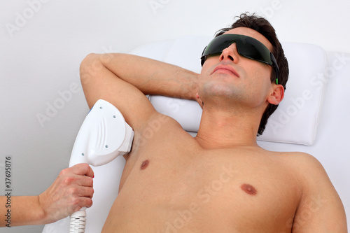 laser hair removal photo