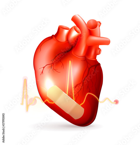 Damaged heart
