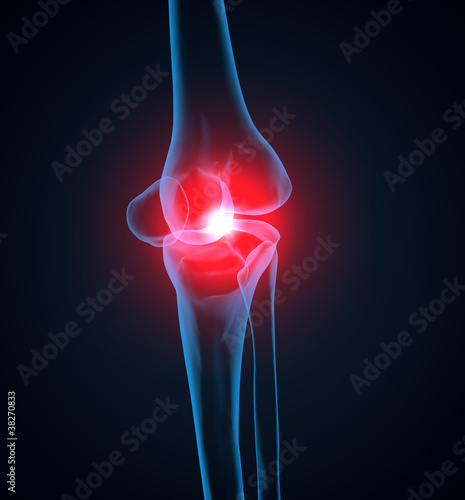 knie schmerzen