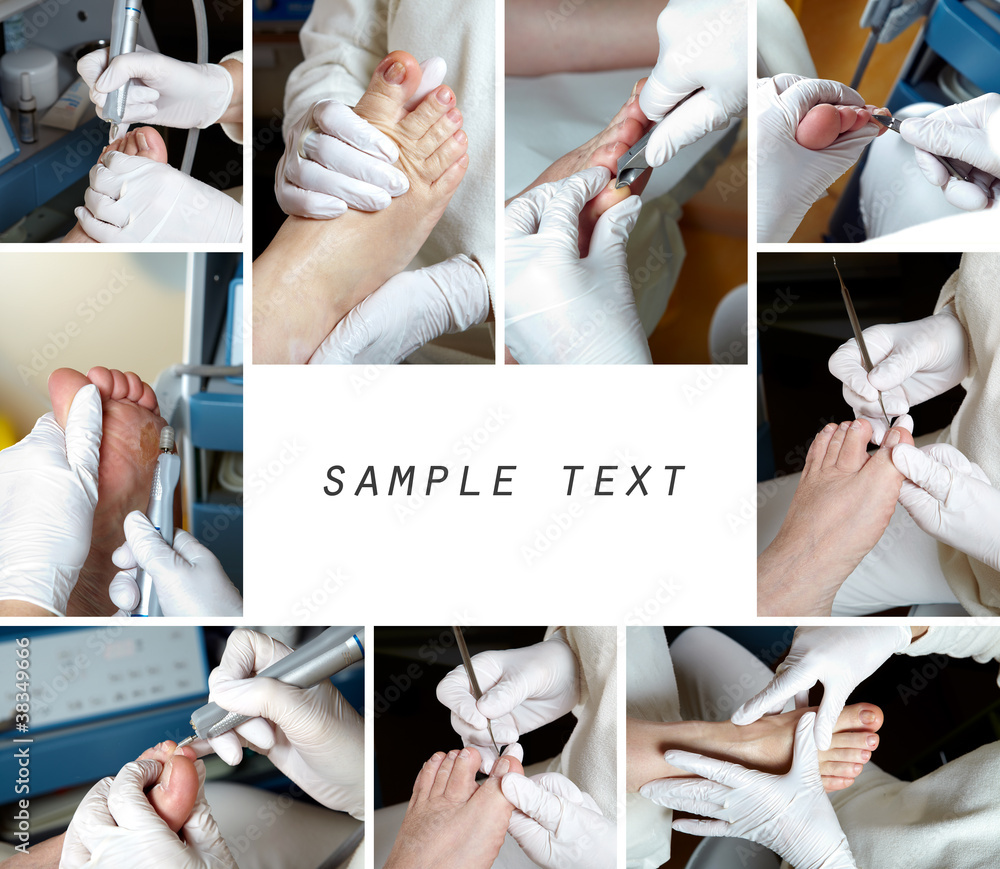 Medizinische Fußpflege -Collage - obrazy, fototapety, plakaty 