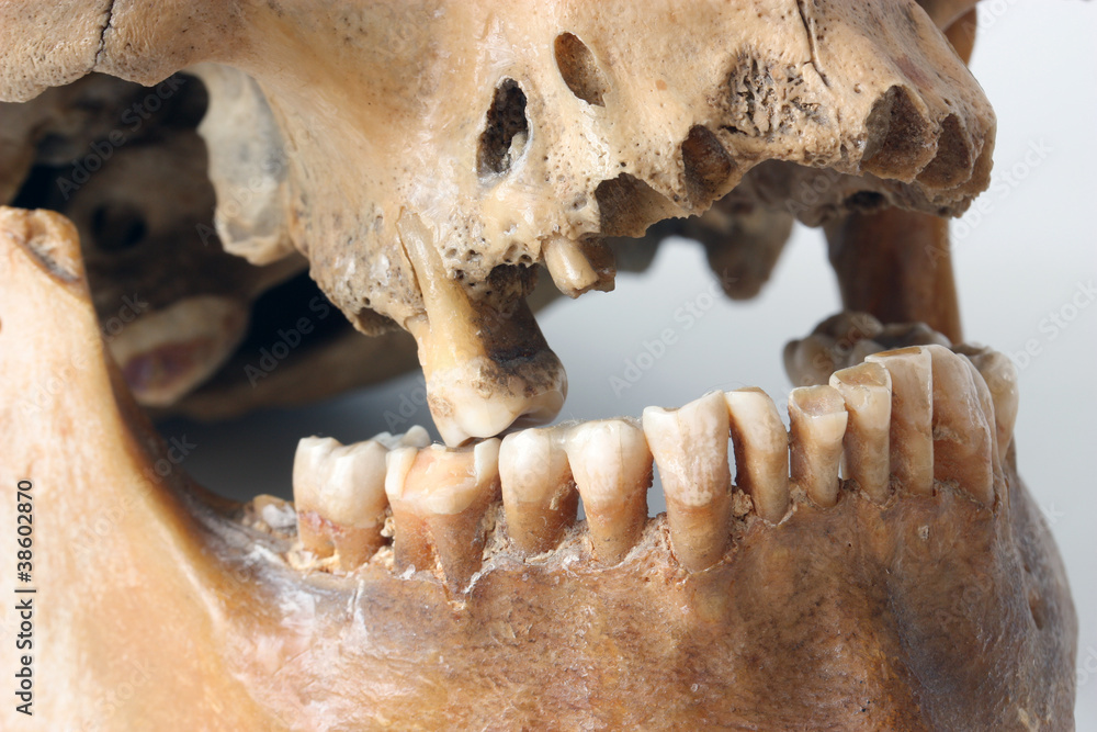 Teeth of the person. Teeth of the person.