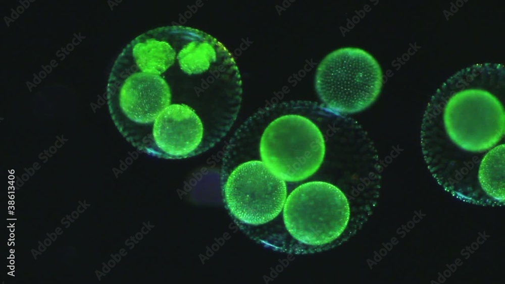 Volvox aureus - Tochterkolonien - Dunkelfeld Volvox aureus - Tochterkolonien - Dunkelfeld