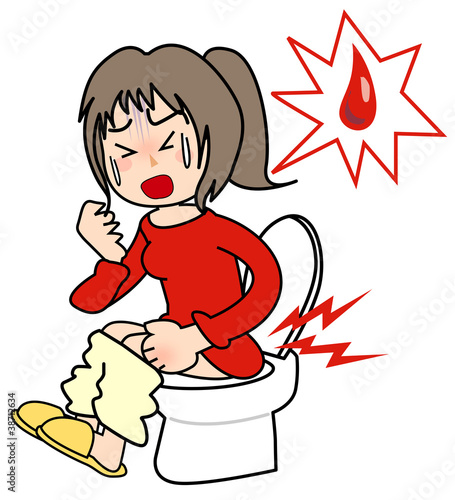 Hemorrhoids