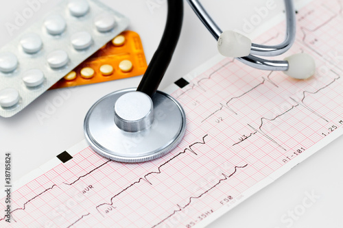 Obraz na plátně Cardiogram with stethoscope