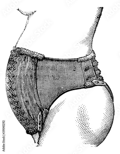 Abdominal belt of Dr. Pinard, vintage engraving.