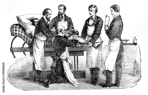 Amputation of the thigh. Positions of the surgeon and assistants