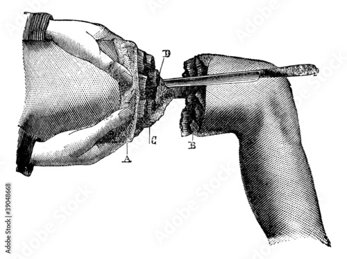 Section of muscle, vintage engraving.