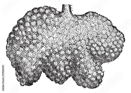 Fig. 4. Intestine, Brunner's glands or duodenal glands, vintage
