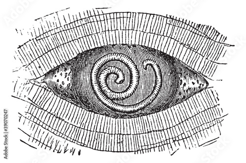Pork Roundworm or Trichinella spiralis, vintage engraving