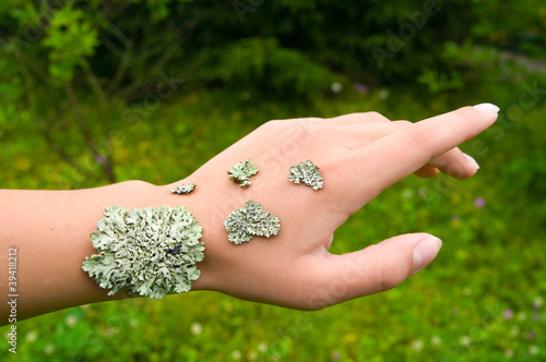 lichen on the hand of young woman symbolizing a skin disease