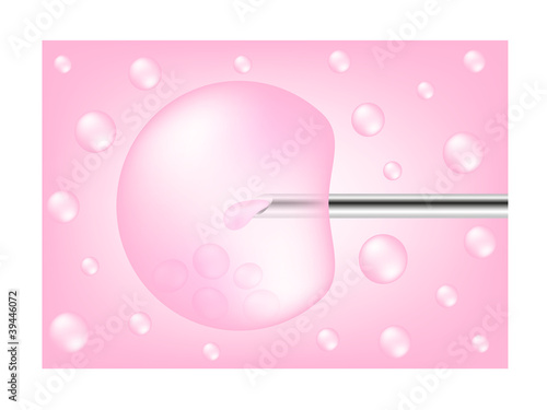 In vitro fertilization process