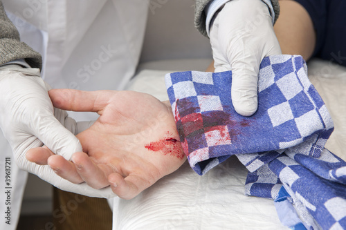 bleeding cut