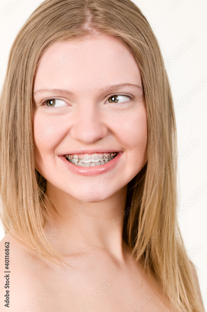 Beautiful young girl with brackets on teeth Beautiful young girl with brackets on teeth