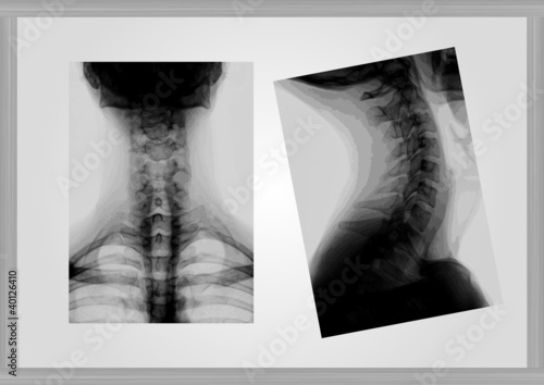 X-ray of neck vector background
