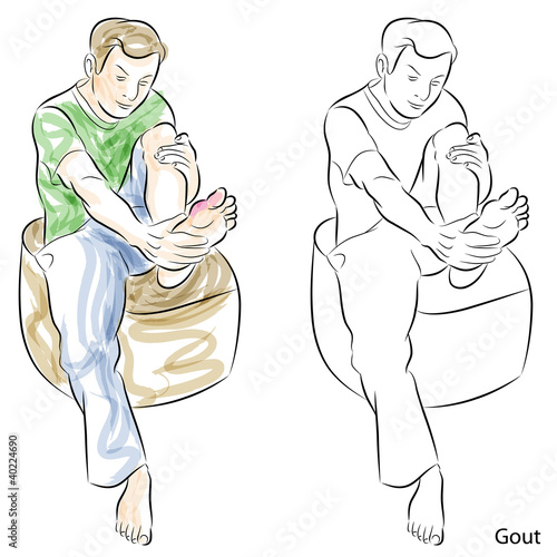 Man Massaging Gout Feet