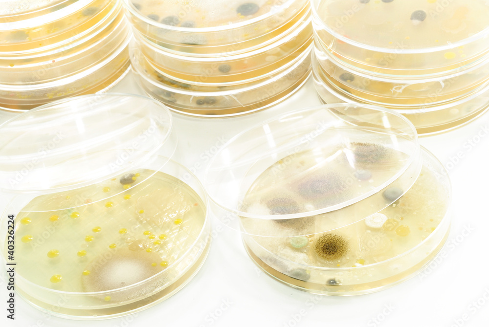 Macro mold and bacterai colonies growing on an agar plates. Macro mold and bacterai colonies growing on an agar plates.