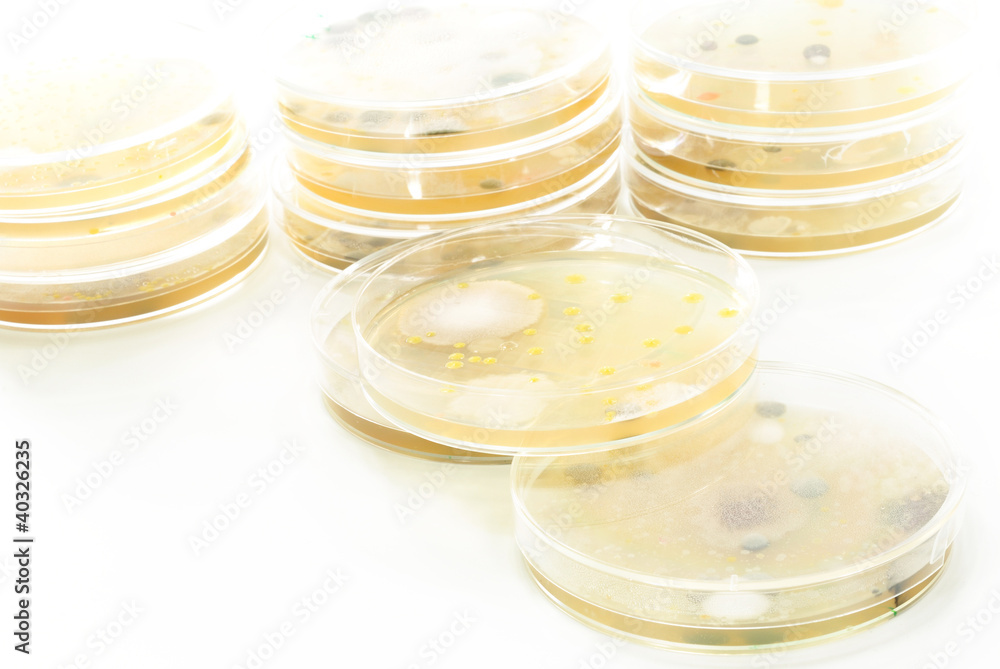 Macro mold and bacterai colonies growing on an agar plates. Macro mold and bacterai colonies growing on an agar plates.