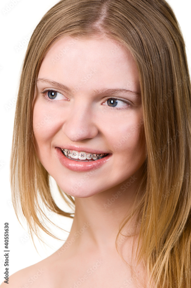 Beautiful young woman with brackets on teeth Beautiful young woman with brackets on teeth
