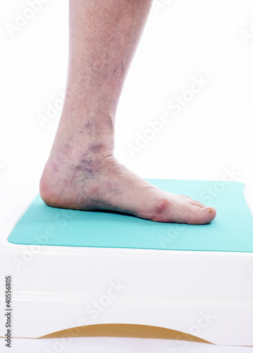 varicosis vains on modular bath step, closeup