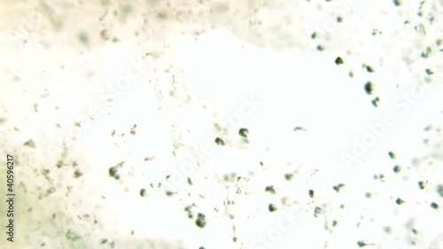 Particles in liquid environment