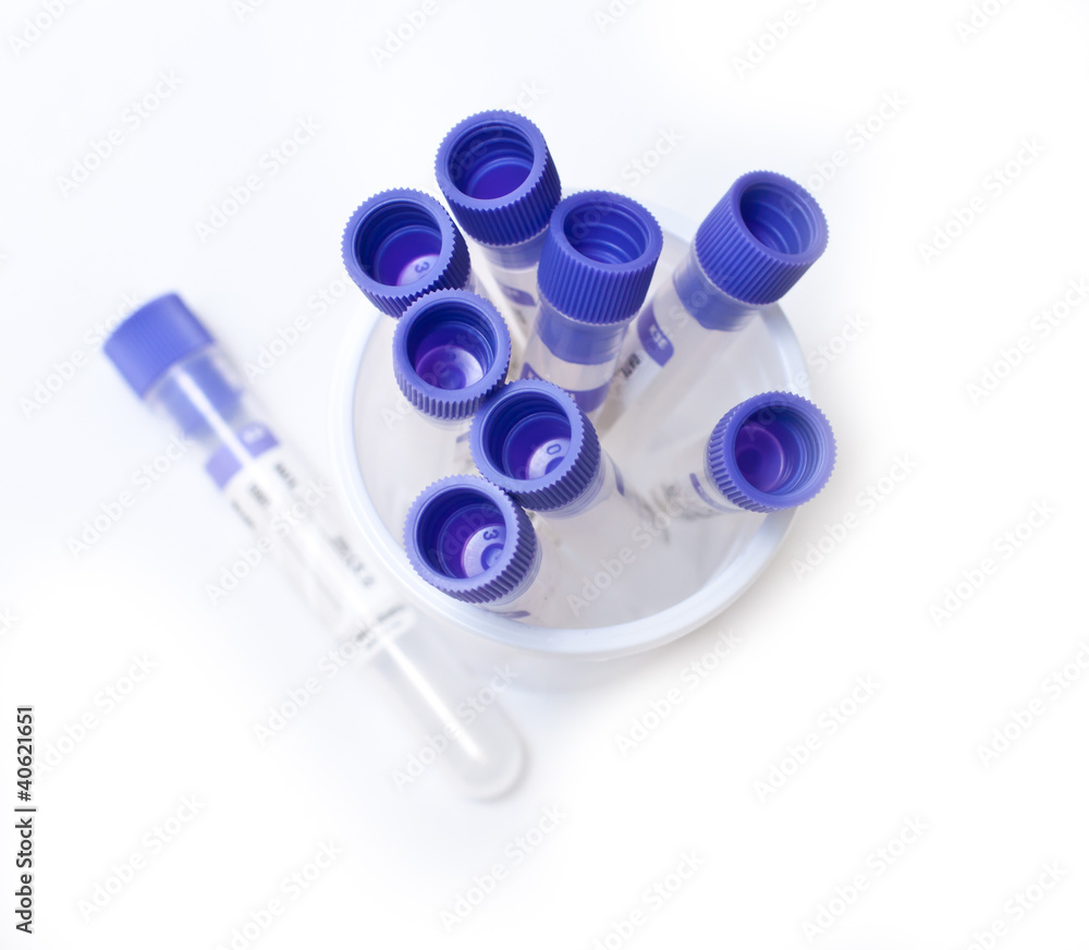 laboratory test tubes laboratory test tubes