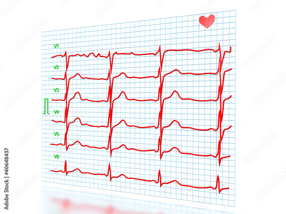 cardiogram on a white background №2